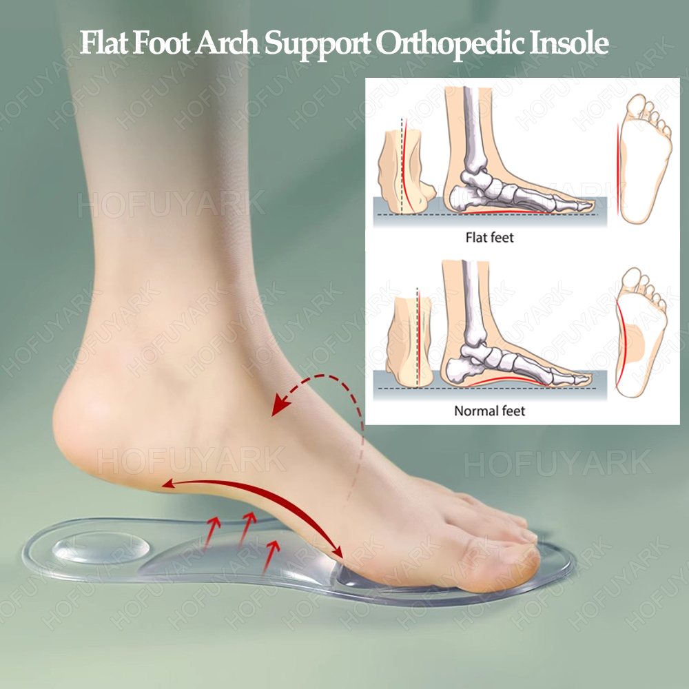 almilhas ortopédicas de gel de - Women'S Shoes For Plantar Fasciitis avaliação e preço